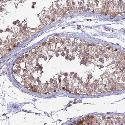 Immunohistochemistry-Paraffin: GOLGA3 Antibody [NBP1-91952] - Staining of human testis shows moderate to strong granular cytoplasmic positivity in cells in seminiferous ducts.