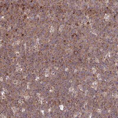 Immunohistochemistry-Paraffin: GOLGA3 Antibody [NBP1-91952] - Staining of human tonsil shows moderate to strong cytoplasmic positivity in germinal center cells.