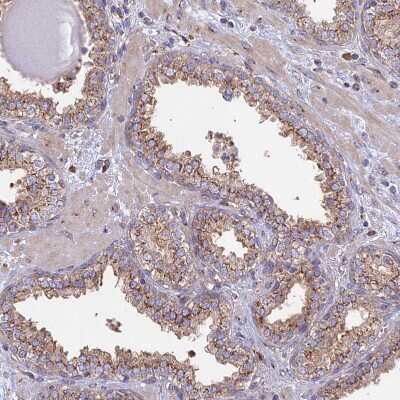 Immunohistochemistry-Paraffin: GOLGA3 Antibody [NBP1-91953] - Staining of human prostate shows moderate granular cytoplasmic positivity in glandular cells.