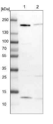 Western Blot: GOLGA3 Antibody [NBP1-91953] - Lane 1: NIH-3T3 cell lysate (Mouse embryonic fibroblast cells)Lane 2: NBT-II cell lysate (Rat Wistar bladder tumour cells)