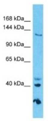 Western Blot: GOLGA3 Antibody [NBP3-09942] - Western blot analysis of GOLGA3 in HepG2 Whole Cell lysates. Antibody dilution at 1.0ug/ml
