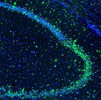 Immunohistochemistry: GOLGA5 Antibody [NBP1-83352] - Staining of mouse hippocampus shows immunoreactivity in a subset of neurons in the CA3 area.