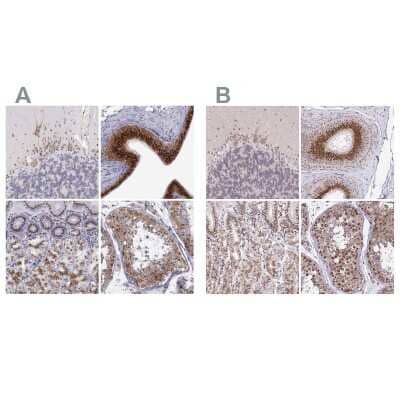 Immunohistochemistry-Paraffin: GOLGA5 Antibody [NBP1-83352] - Staining of human cerebellum, epididymis, stomach and testis using Anti-GOLGA5 antibody NBP1-83352 (A) shows similar protein distribution across tissues to independent antibody NBP2-39007 (B).