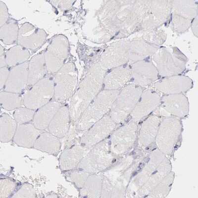 Immunohistochemistry-Paraffin: GOLGA5 Antibody [NBP1-83352] - Staining of human skeletal muscle shows no positivity in myocytes as expected.