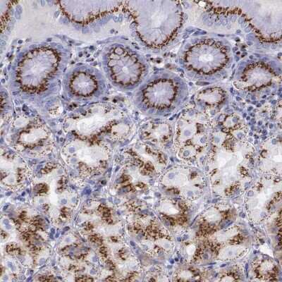 Immunohistochemistry-Paraffin: GOLGA5 Antibody [NBP1-83352] - Staining of human stomach shows moderate to strong granular cytoplasmic positivity in glandular cells.