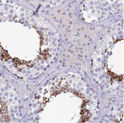 Immunohistochemistry-Paraffin: GOLGA6 Antibody [NBP2-54716] - Staining of human testis shows strong cytoplasmic positivity in cells in seminiferus ducts.