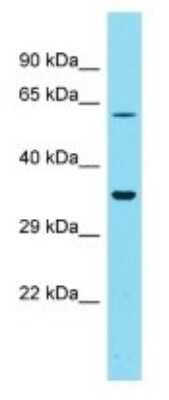 Western Blot: GOLGA6L4 Antibody [NBP3-09728] - Western blot analysis of GOLGA6L4 in PANC1 Whole Cell lysates. Antibody dilution at 1.0ug/ml