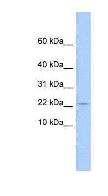 Western Blot: GOLGA7B Antibody [NBP1-56754] - 721_B cell lysate, concentration 0.2-1 ug/ml.