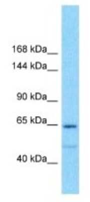 Western Blot: GOLGA8IP Antibody [NBP3-09919] - Western blot analysis of GOLGA8IP in 293T Whole Cell lysates. Antibody dilution at 1.0ug/ml