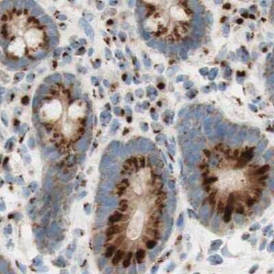 Immunohistochemistry-Paraffin: GOLGB1/Giantin Antibody [NBP1-91937] - Staining of human colon.