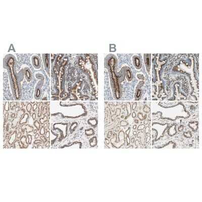 Immunohistochemistry-Paraffin: GOLGB1/Giantin Antibody [NBP1-91937] - Staining of human endometrium, gastrointestinal, kidney and prostate using Anti-GOLGB1/Giantin antibody NBP1-91937 (A) shows similar protein distribution across tissues to independent antibody NBP1-91938 (B).