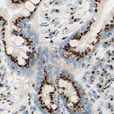 Immunohistochemistry-Paraffin: GOLGB1/Giantin Antibody [NBP1-91938] - Staining of human colon.