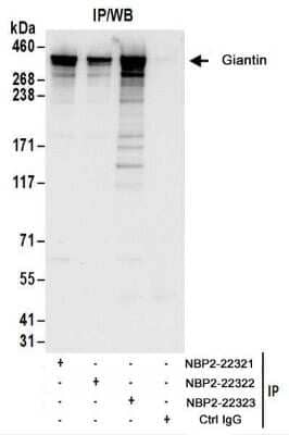 <b>Biological Strategies Validation. </b>Immunoprecipitation: GOLGB1/Giantin Antibody [NBP2-22323] - Whole cell lysate (1 mg for IP; 20% of IP loaded) from 293T cells.  Antibodies:  NBP2-22323 used for IP at 6 ug/mg lysate.  Giantin was also immunoprecipitated by rabbit anti-Giantin antibodies NBP2-22321 and NBP2-22322.  For blotting immunoprecipitated Giantin, NBP2-22323 was used at 1 ug/ml.  Detection: Chemiluminescence with an exposure time of 10 seconds.
