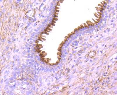 Immunohistochemistry-Paraffin: GOLM1 Antibody (JA63-03) [NBP2-66876] - Analysis of paraffin-embedded human prostate tissue using anti-GOLPH2 antibody. Counter stained with hematoxylin.