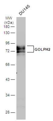 GOLM1 Antibody [NBP2-16706] - Wild-type (WT) and GOLPH2 knockout (KO) 293T cell extracts (30 ug) were separated by 7.5% SDS-PAGE, and the membrane was blotted with GOLM1 antibody diluted at 1:1000. HRP-conjugated anti-rabbit IgG antibody was used to detect the primary antibody.