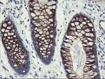 Immunohistochemistry: GOLM1 Antibody (OTI4B12) - Azide and BSA Free [NBP2-71916] - Staining of paraffin-embedded Human colon tissue using anti-GOLM1 mouse monoclonal antibody.