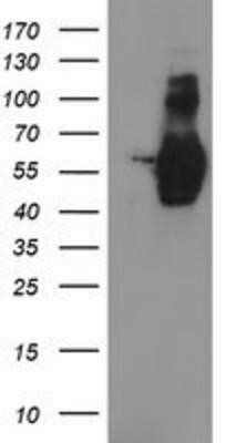 Western Blot: GOLM1 Antibody (OTI4B12) - Azide and BSA Free [NBP2-71916] - HEK293T cells were transfected with the pCMV6-ENTRY control (Left lane) or pCMV6-ENTRY GOLM1 (Right lane) cDNA for 48 hrs and lysed. Equivalent amounts of cell lysates (5 ug per lane) were separated by SDS-PAGE and immunoblotted with anti-GOLM1.