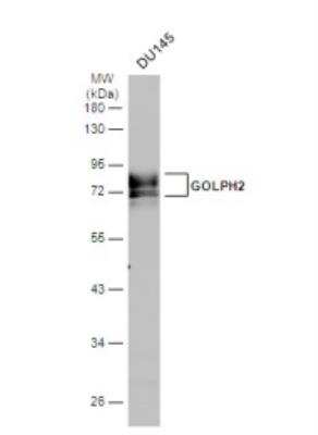 Western Blot: GOLM1 Antibody [NBP2-16706] - Whole cell extract (30 ug) was separated by 10% SDS-PAGE, and the membrane was blotted with GOLPH2 antibody diluted at 1:500. The HRP-conjugated anti-rabbit IgG antibody (NBP2-19301) was used to detect the primary antibody.