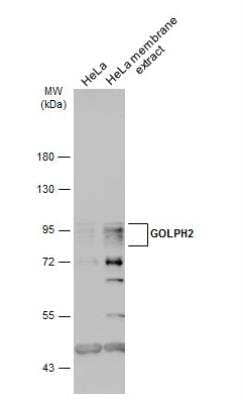 Western Blot: GOLM1 Antibody [NBP2-16706] - HeLa whole cell and membrane extracts (30 ug) were separated by 7.5% SDS-PAGE, and the membrane was blotted with GOLPH2 antibody diluted at 1:1000. The HRP-conjugated anti-rabbit IgG antibody (NBP2-19301) was used to detect the primary antibody.