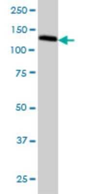 Western Blot: GOLPH4 Antibody (5E11) [H00027333-M01] - GOLPH4 monoclonal antibody (M01), clone 5E11 Analysis of GOLPH4 expression in HeLa.