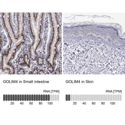 Immunohistochemistry-Paraffin: GOLPH4 Antibody [NBP1-91954] - Analysis in human small intestine and skin tissues using NBP1-91954 antibody. Corresponding GOLIM4 RNA-seq data are presented for the same tissues.