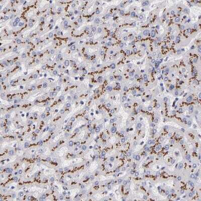 Immunohistochemistry-Paraffin: GOLPH4 Antibody [NBP1-91954] - Staining of human liver shows strong granular cytoplasmic positivity in hepatocytes.