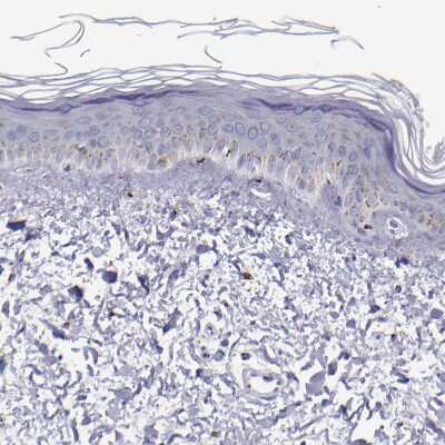 Immunohistochemistry-Paraffin: GOLPH4 Antibody [NBP1-91954] - Staining of human skin shows moderate granular cytoplasmic positivity in a small subset of squamous epithelial cells.