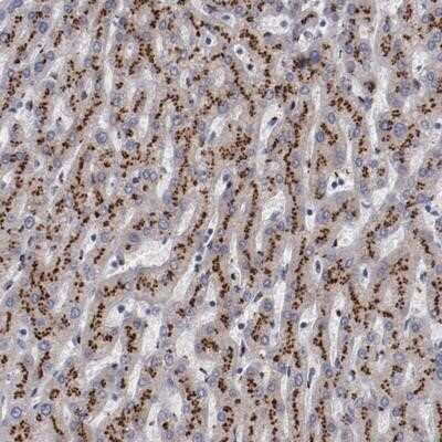 Immunohistochemistry-Paraffin: GOLPH4 Antibody [NBP1-91955] - Staining of human liver shows strong cytoplasmic positivity with granular pattern in hepatocytes.