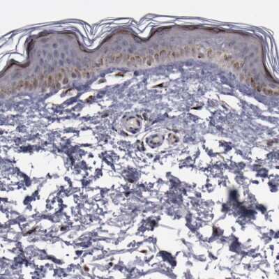 Immunohistochemistry-Paraffin: GOLPH4 Antibody [NBP1-91955] - Staining of human skin shows low expression as expected.