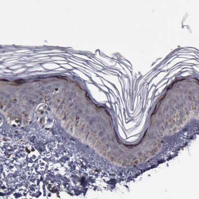 Immunohistochemistry-Paraffin: GOLPH4 Antibody [NBP1-91955] - Staining of human skin shows moderate granular cytoplasmic positivity in a small subset of squamous epithelial cells.