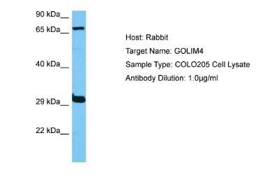 Western Blot: GOLPH4 Antibody [NBP2-87517] - Host: Rabbit. Target Name: GOLIM4. Sample Tissue: Human COLO205 Whole Cell lysates. Antibody Dilution: 1ug/ml
