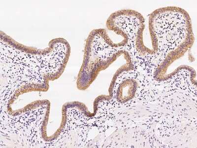 Immunohistochemistry-Paraffin: GOSR1 Antibody [NBP2-97808] - Immunochemical staining of human GOSR1 in human gallbladder with rabbit polyclonal antibody at 1:100 dilution, formalin-fixed paraffin embedded sections.