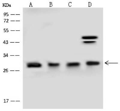 Western Blot: GOSR1 Antibody [NBP2-97808] - Anti-GOSR1 rabbit polyclonal antibody at 1:500 dilution. Lane A: SKBR-3 Whole Cell Lysate Lane B: NIH-3T3 Whole Cell Lysate Lane C: A431 Whole Cell Lysate Lane D: U-251 MG Whole Cell Lysate Lysates/proteins at 30 ug per lane. Secondary Goat Anti-Rabbit IgG (H+L)/HRP at 1/10000 dilution. Developed using the ECL technique. Performed under reducing conditions. Predicted band size: 29 kDa. Observed band size: 29 kDa (We are unsure as to the identity of these extra bands).