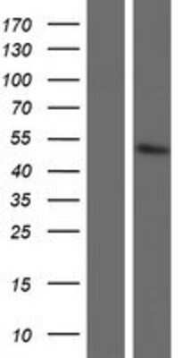 Western Blot: GOT1L1 Overexpression Lysate (Adult Normal) [NBP2-05384] Left-Empty vector transfected control cell lysate (HEK293 cell lysate); Right -Over-expression Lysate for GOT1L1.