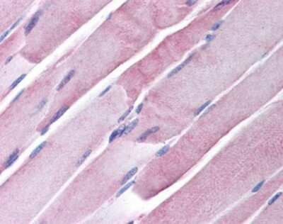 Immunohistochemistry-Paraffin: GOT2 Antibody [NBP1-03304] - Staining of human skeletal muscle. Immunohistochemistry of formalin-fixed, paraffin-embedded tissue after heat-induced antigen retrieval. Antibody concentration 20 ug/ml.