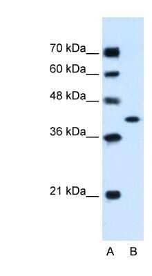 Western Blot: GOT2 Antibody [NBP1-80521] - HepG2 cell lysate, Antibody Titration: 1.25ug/ml