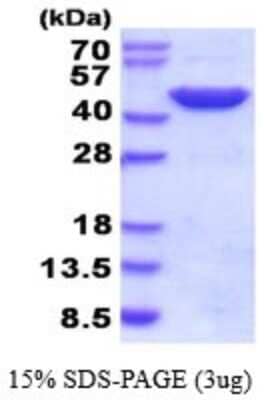 SDS-Page: Recombinant Human GOT2 Protein [NBP2-52146] - 15% SDS Page (3 ug)