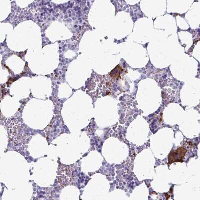 Immunohistochemistry-Paraffin: GP-IX Antibody [NBP2-38018] - Staining of human bone marrow shows strong cytoplasmic positivity in megakaryocytes.