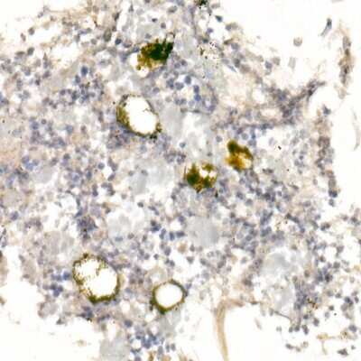 Immunohistochemistry-Paraffin: GP-IX Antibody [NBP3-03507] - Rat bone marrow using GP-IX Rabbit pAb (NBP3-03507) at dilution of 1:25 (40x lens). Perform high pressure antigen retrieval with 10 mM citrate buffer pH 6.0 before commencing with IHC staining protocol.