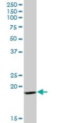 Western Blot: GP-IX Antibody [H00002815-B01P] - Analysis of GP9 expression in human spleen.