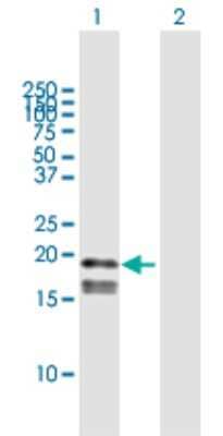 Western Blot: GP-IX Antibody [H00002815-B01P] - Analysis of GP9 expression in transfected 293T cell line by GP9 polyclonal antibody.  Lane 1: GP9 transfected lysate(19.47 KDa). Lane 2: Non-transfected lysate.