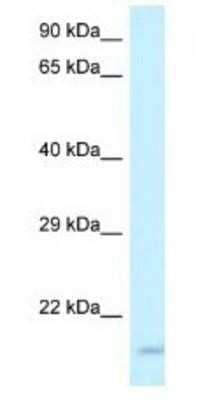 Western Blot: GP-IX Antibody [NBP1-79895] - ACHN Cell Lysate 1ug/ml Gel Concentration 12%