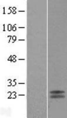 Western Blot: GP-IX Overexpression Lysate (Adult Normal) [NBL1-11212] Left-Empty vector transfected control cell lysate (HEK293 cell lysate); Right -Over-expression Lysate for GP-IX.