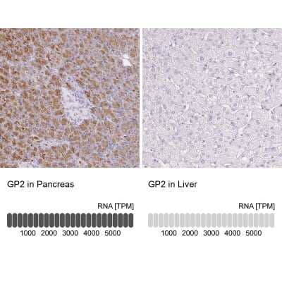 Immunohistochemistry-Paraffin: GP2 Antibody [NBP1-86061] - Staining in human pancreas and liver tissues using anti-GP2 antibody. Corresponding GP2 RNA-seq data are presented for the same tissues.