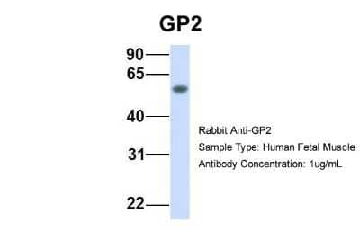 Western Blot: GP2 Antibody [NBP1-59912] - Sample Type: Human Fetal Muscle Antibody Dilution: 1.0 ug/ml