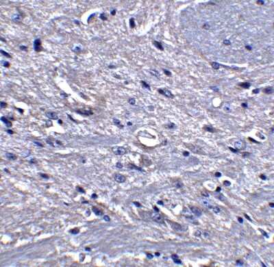 Immunohistochemistry-Paraffin: GPAM Antibody [NBP1-76907] - Staining of GPAT1 in mouse brain tissue with GPAT1 antibody at 5 ug/ml.