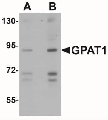 Western Blot: GPAM Antibody [NBP1-76907] - Western blot analysis of GPAT1 in rat brain tissue lysate with GPAT1 antibody at (A) 1 and (B) 2 ug/mL.