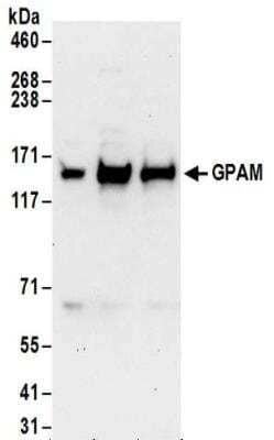 Western Blot: GPAM Antibody [NBP2-32116] - Whole cell lysate (50 ug) from HeLa, 293T, and Jurkat cells.  Antibodies:  Affinity purified rabbit anti-GPAM antibody NBP2-32116 used for WB at 1 ug/ml.  Detection: Chemiluminescence with an exposure time of 30 seconds.