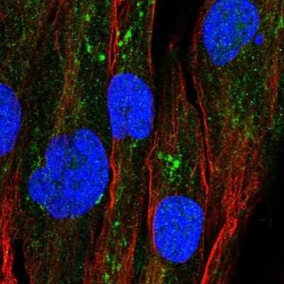 Immunocytochemistry/ Immunofluorescence GPAT2 Antibody