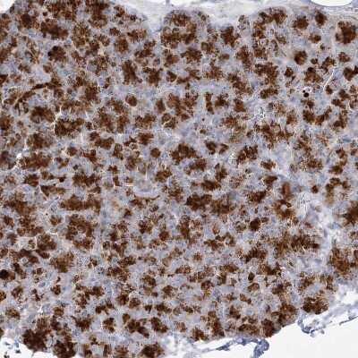 Immunohistochemistry-Paraffin GPAT2 Antibody